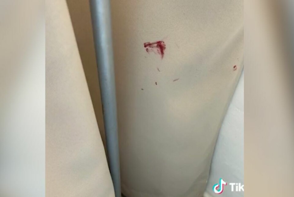 – Det ser ut som blod, sier TikTok-brukeren om det hun fant på hotellet.
