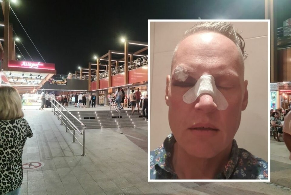Brutalt slått ned av nordmann på Gran Canaria: – Dette er hatvold