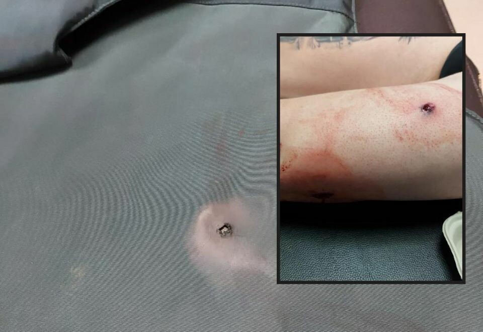 Politimann skutt på Gran Canaria – gjerningsmann på frifot