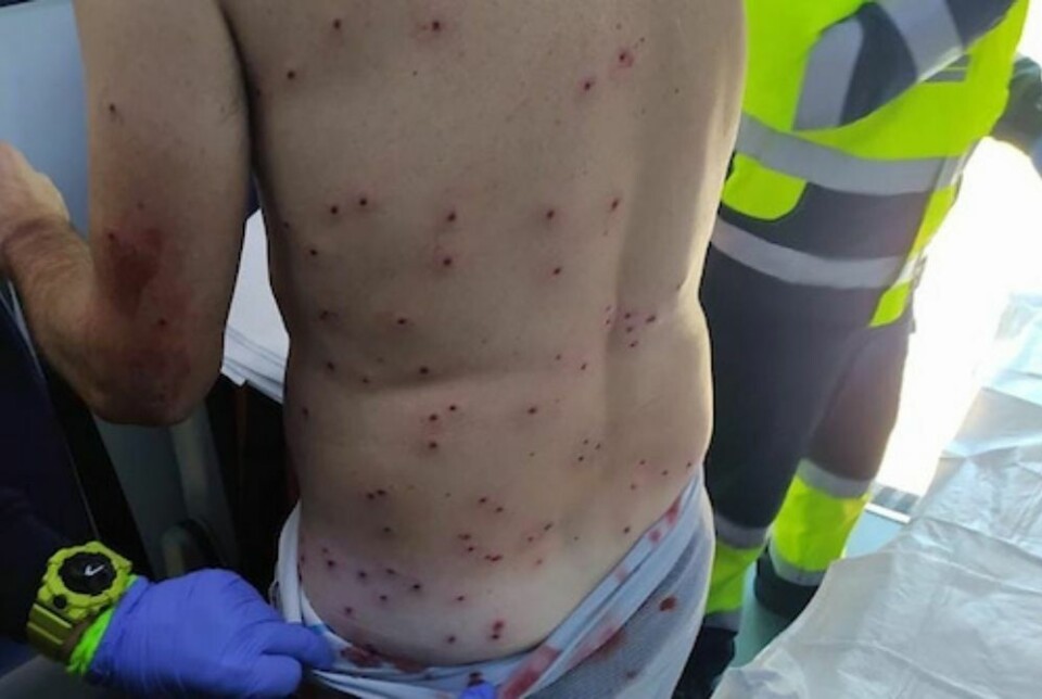 Syklist forvekslet med kanin – pepret av hagleskudd fra jeger